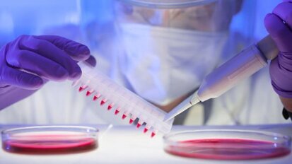 Pesquisadores de Odontologia completam teste de HIV para uso no mundo em desenvolvimento