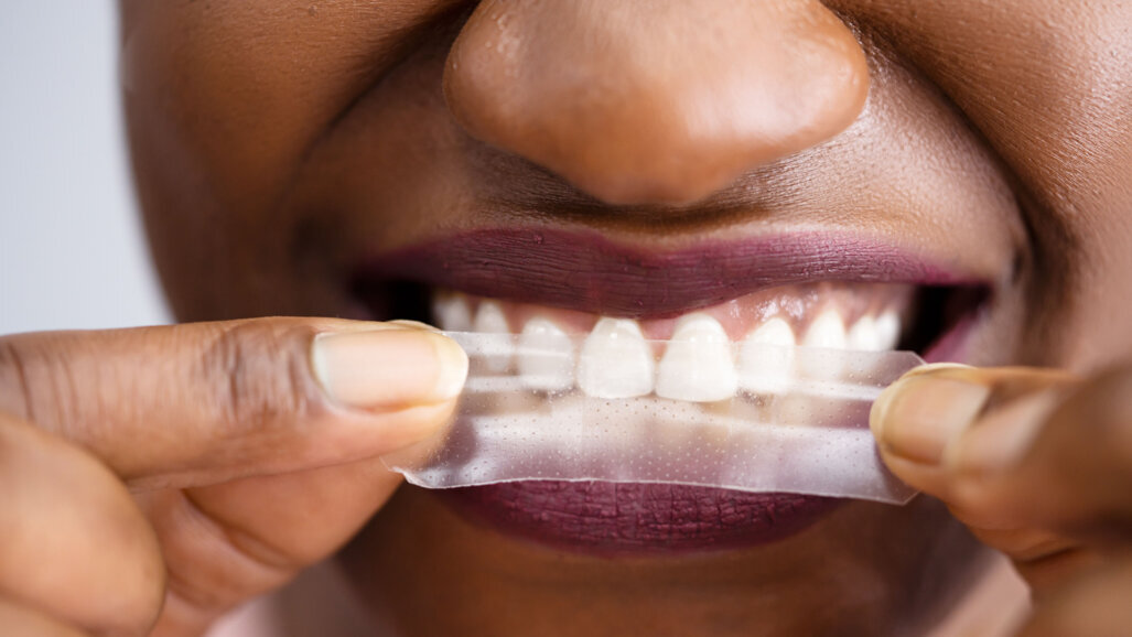 Non-peroxide whitening strips offer bright competition