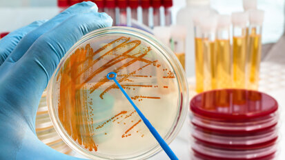 Studie: Zusammenhang von Zahnbehandlungen und Endokarditis Studie: Zusammenhang von Zahnbehandlungen und Endokarditis