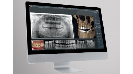 Dentsply Sirona – SIDEXIS 4