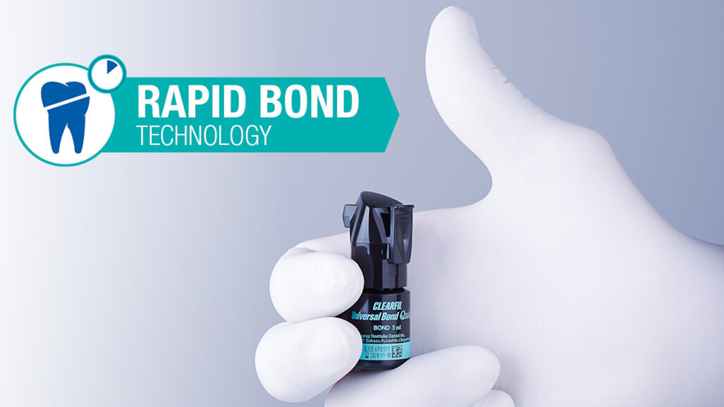 Technologie Rapid Bond : des adhésifs efficaces et durables