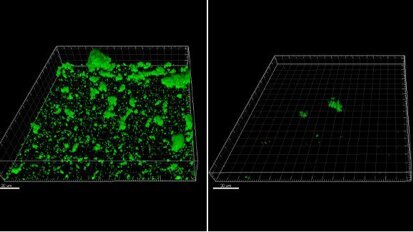 Aminoácido natural comum pode tornar-se novo meio de controlar biofilme dental