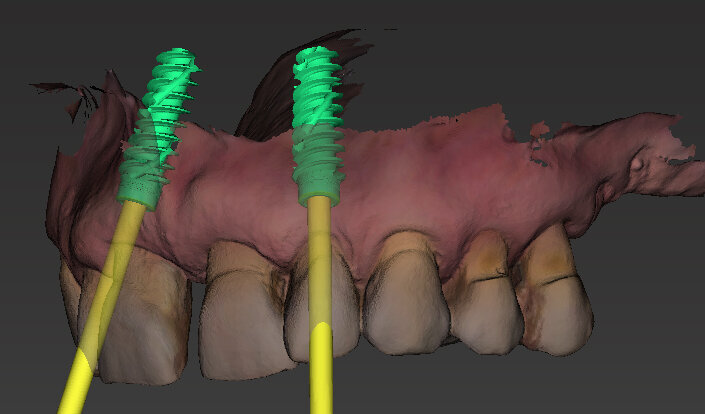 Fig. 11 - Posizionamento virtuale dell’impianto 2.2.