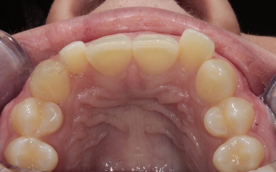 7. Initiële situatie, occlusaal