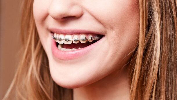 Orthodontisch kwaliteitsregister voor tandartsen