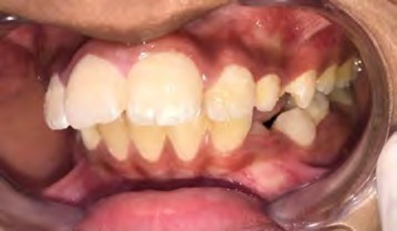 1i