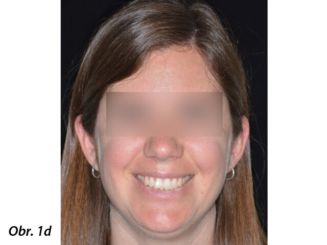 Pacientka 1 – Počáteční fotografie.