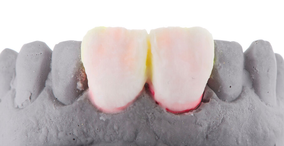 Fig. 9: Prepared for the second firing