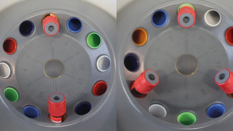 Co dělat a nedělat při manipulaci s fibrinem bohatým na krevní destičky (PRF)