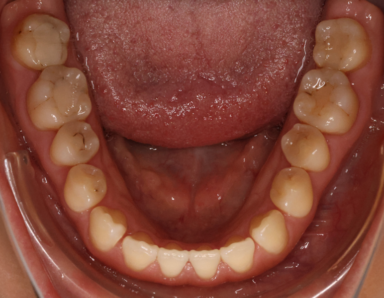Fig. 9e