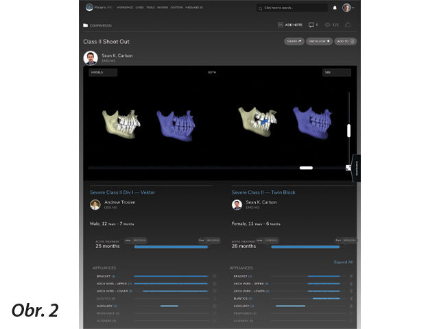 Funkce porovnání případů umožňuje ortodontistům porovnávat dva případy léčené pomocí různých protokolů. Zubní lékaři mohou také porovnat ověřený časový rámec ošetření včetně použitých aparátů.
