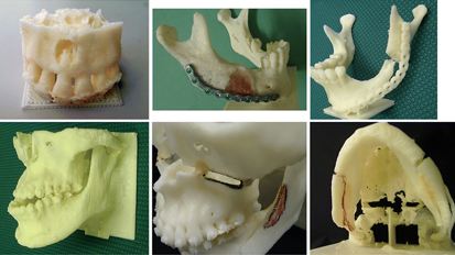 Researchers develop environment for manufacture of inexpensive 3-D dental models Researchers develop environment for manufacture of inexpensive 3-D dental models
