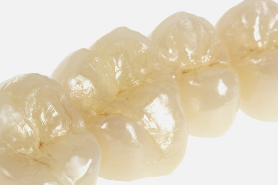 Fig. 17: The objective
is a high-quality surface with a matt finish. Only the small occlusal
contact or functional surfaces are polished to a high gloss.