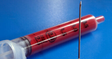 Platelet-rich plasma helps after extractions