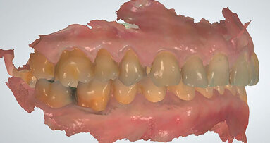 L’ortodonzia nell’era del digitale: il conflitto di meraviglie secondo Einstein