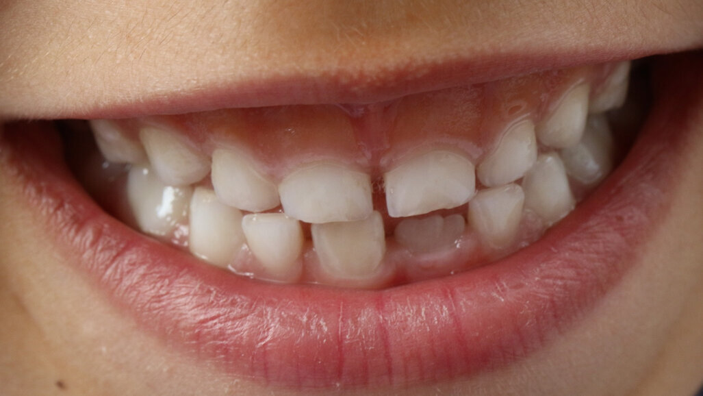 Bank tkanek i komórek obszaru jamy ustnej częścią Mapy Innowacji w ochronie zdrowia