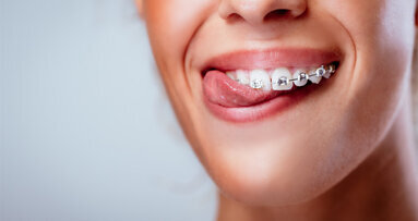 Zahnspange soll bei Gewichtsreduktion helfen