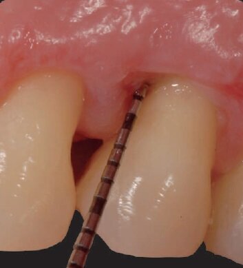 Fig. 12a - Situazione clinica.