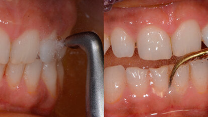 L’igienista dentale? Null’altro che il “dental coach” del paziente