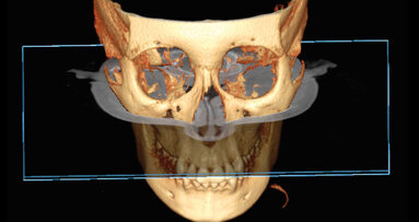 Význam 3D zobrazovacích systémů v současné ortodoncii