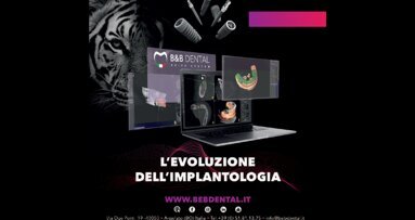 Chirurgia guidata B&B Dental Aspetti pratici e vantaggi