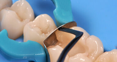 3ssential Kit By Werestore.It: The easiest way for restoratives