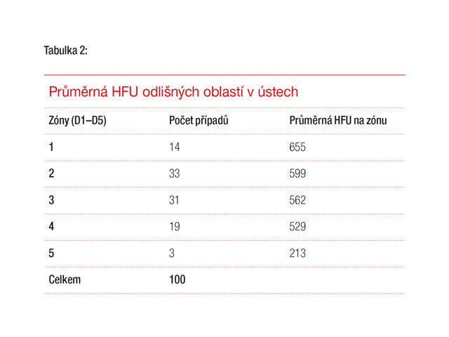 Zóny na CBCT čelisti