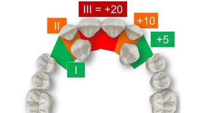 Protocolo para el pronóstico de los caninos superiores retenidos