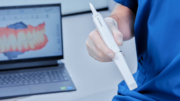 SHINING 3D Dental launches Aoralscan Elf intra-oral scanner