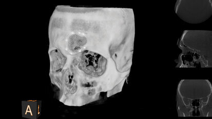 Imaging system helps gain patient acceptance and eliminate surprises