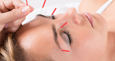 Mit Akupunktur gegen die Zahnarztangst