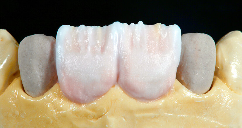 Fig. 10. A continuación se personalizó con TRANSLUCENT 5 (T5: azul claro) y con NECK 4 (N4: naranja).