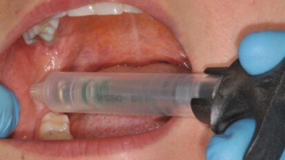 Porównanie metod znieczulenia przewodowego nerwu zębodołowego dolnego – badania własne