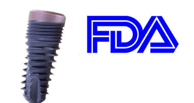 Keystone implant system receives clearance in the US