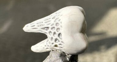 Implanty na miarę – idealnie dopasowane i pozwalające na wrastanie tkanki kostnej