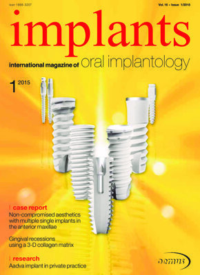 implants international No. 1, 2015 implants international No. 1, 2015