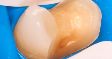 Stomatologia cyfrowa w codziennej praktyce