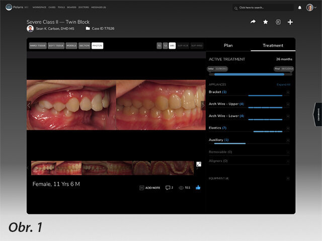 Detailní pohled na kartu pacienta (CaseCard) zobrazující sdílení záznamů a ověřený průběh terapie z platformy CTI Polaris (OrthoScience).