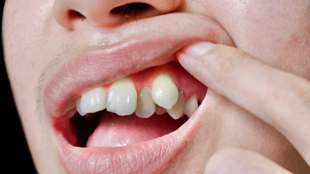 China emergindo como chave no mercado ortodôntico e de alinhadores claros