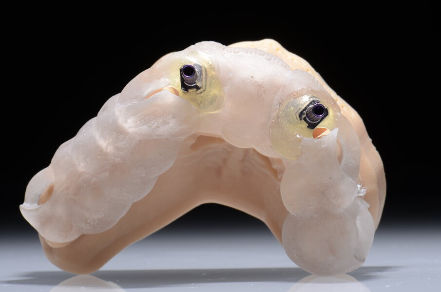 Fig. 41 - Resina trasparente e analoghi bloccati.