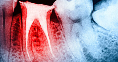 X Congresso Internazionale AIO, a Chia l’indagine in endodonzia si colora di “giallo”