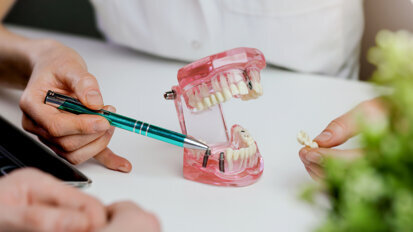 Early microbial determinants of peri-implant health discovered in a new study