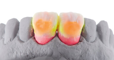 Sunny prospects: Using power to achieve brightness