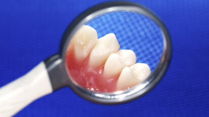 Harde woorden PvdA-kamerlid over vrije tarieven