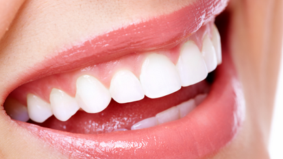 Studie belegt Vorteile der Zahnkorrektur Studie belegt Vorteile der Zahnkorrektur