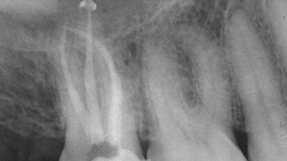 The perceptions of a David in a land of Goliaths