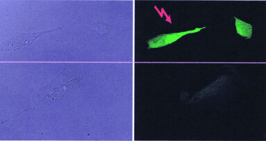Photodamage of dental pulpa stem cells during 700 fs laser exposure