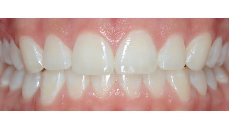 Foto 12. Resultado final del tratamiento.
