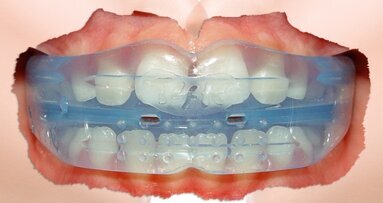 Una ortodoncia divertida