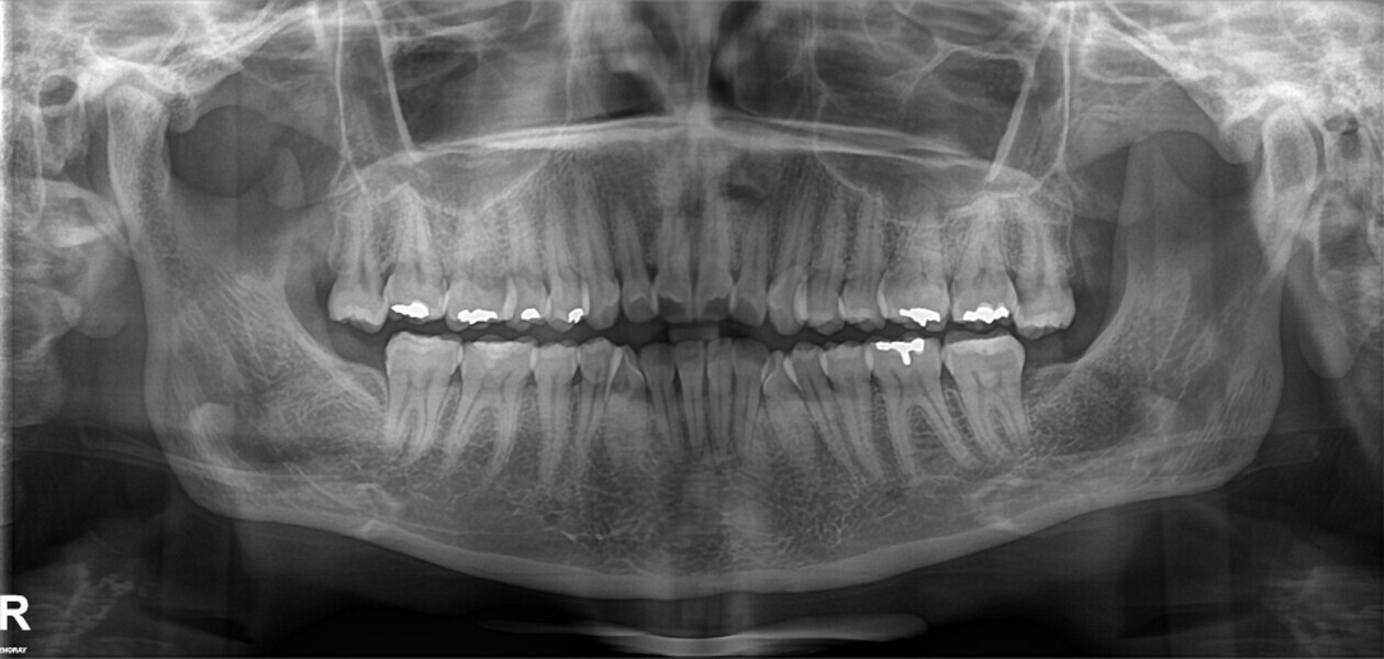 Fig. 4b: Initial cephalometric radiograph and dental panoramic tomogram.